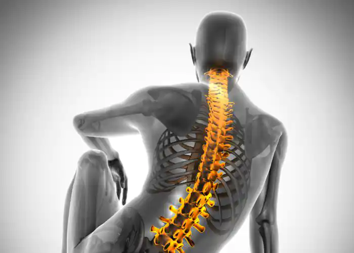 Fractured-Vertebrae-and-Herniated-Discs2