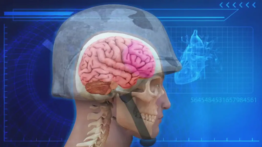 Traumatic-Brain-Injury-main